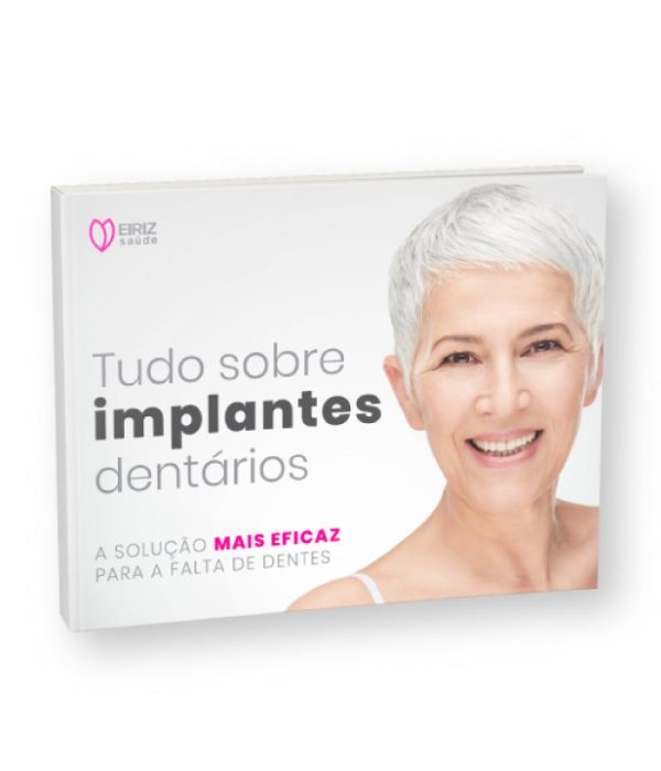 ebook-implantes-dentarios